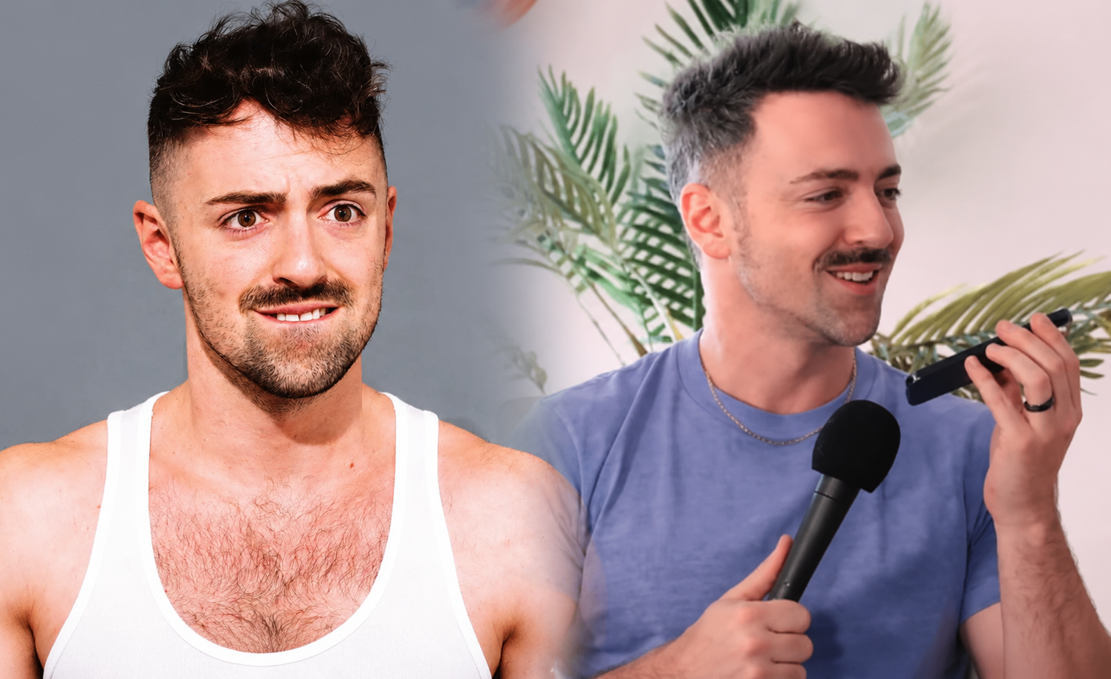 Matteo Lane Hair Transplant